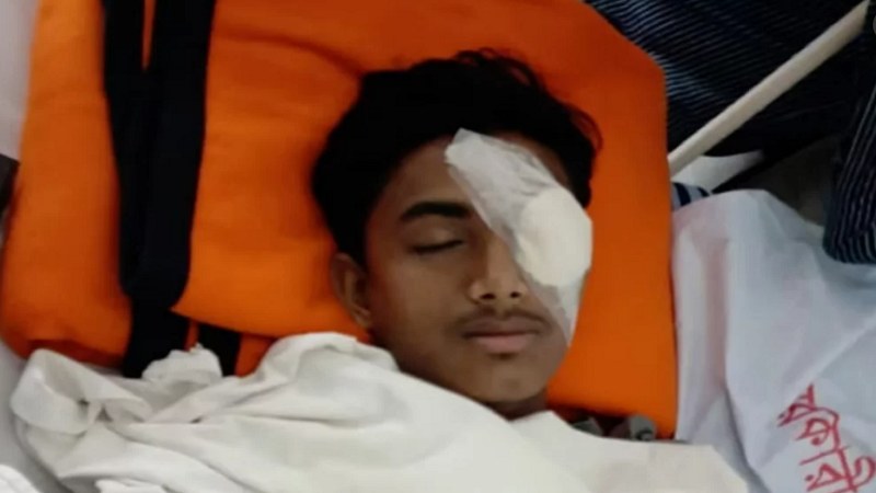 হবিগঞ্জে হামলায় চোখ হারালেন আলিফ, চিকিৎসা চলছে