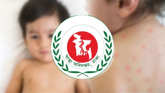 হাম সন্দেহে আরও ৫ শিশুর মৃত্যু, মোট মৃতের সংখ্যা ৭৫৮